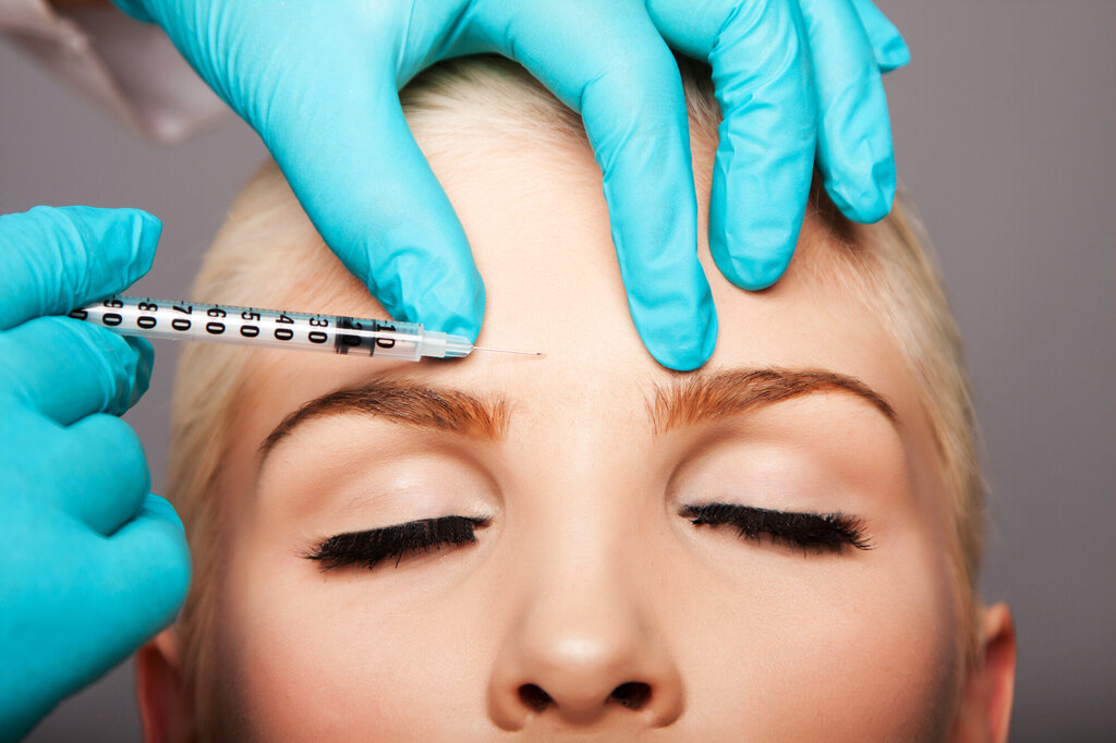 Bildet viser en kvinne som for injisert botox