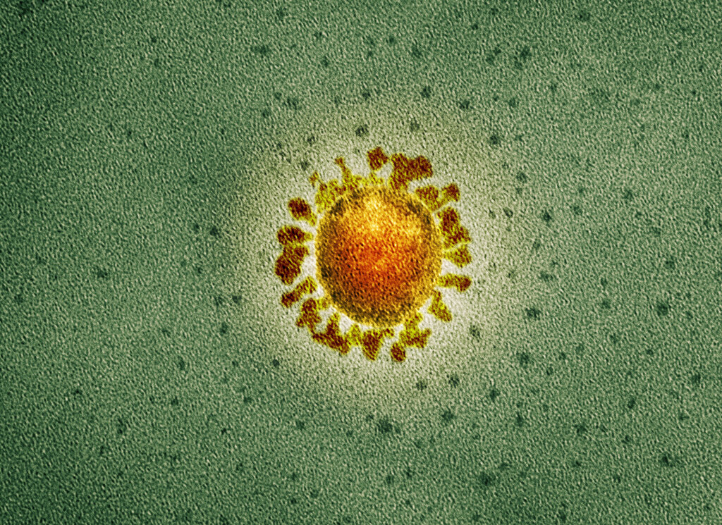 Covid-19 coronavirus