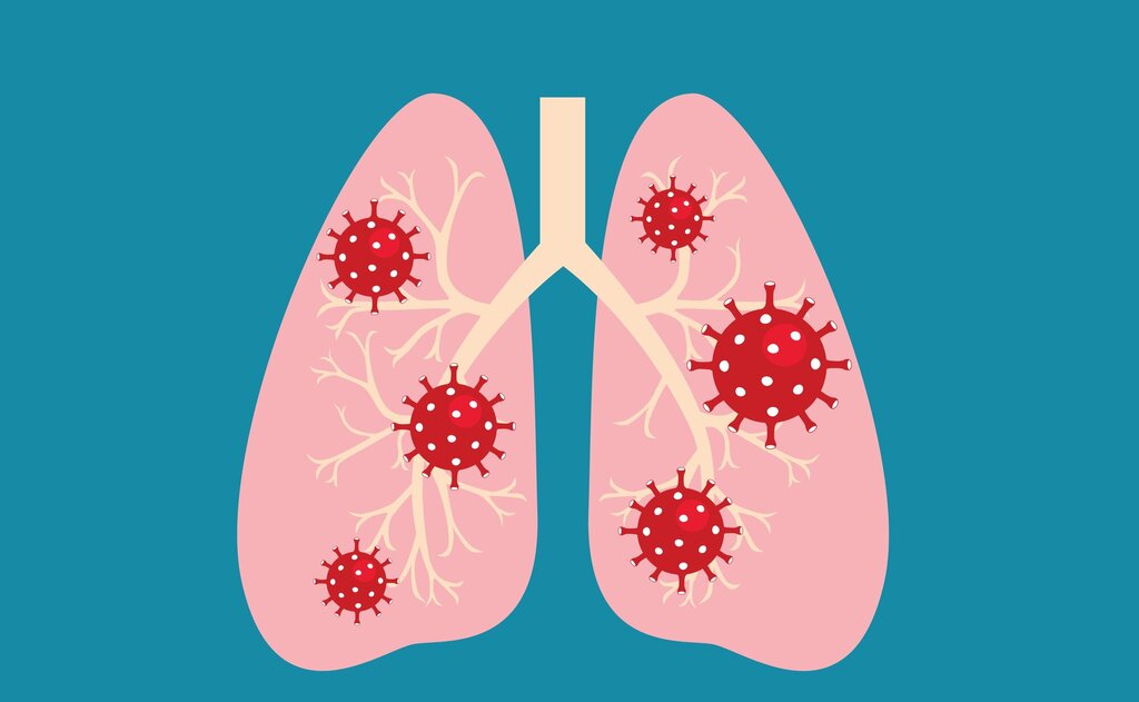 Illustrasjonen viser lunger med koronavirus.