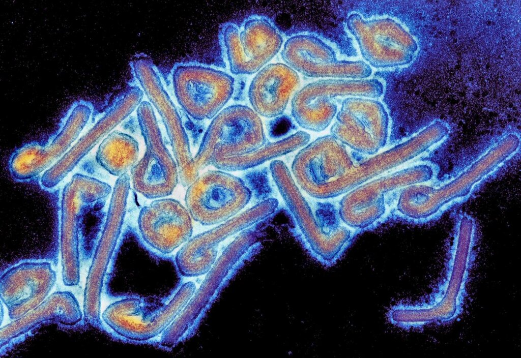 Bildet viser et mikrofotografi av et marburgvirus 