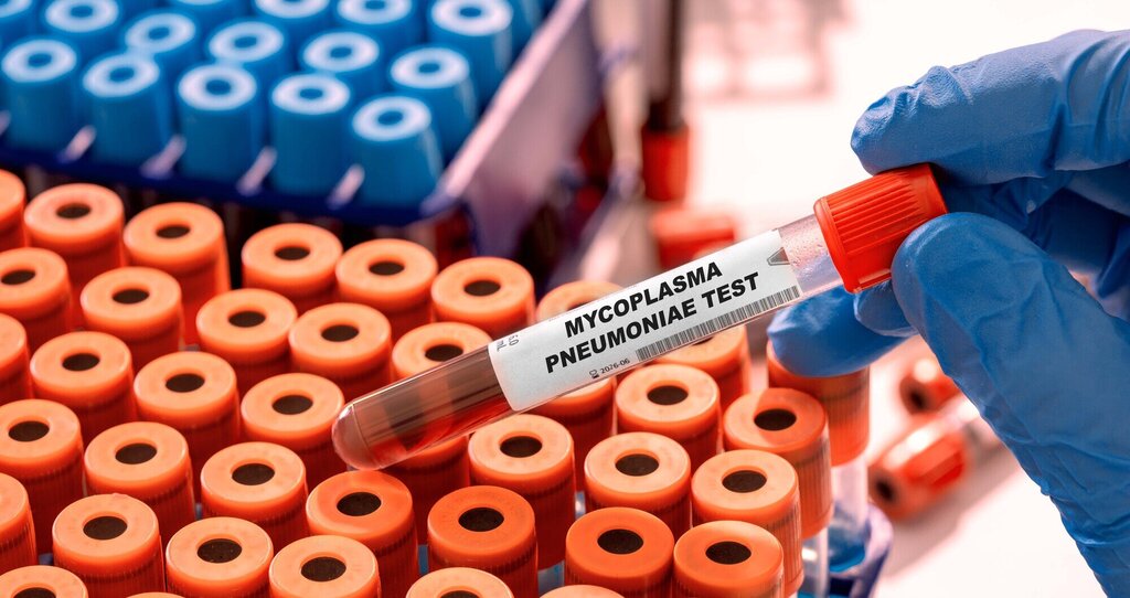 Bilde av mycoplasma pneumoniae-test