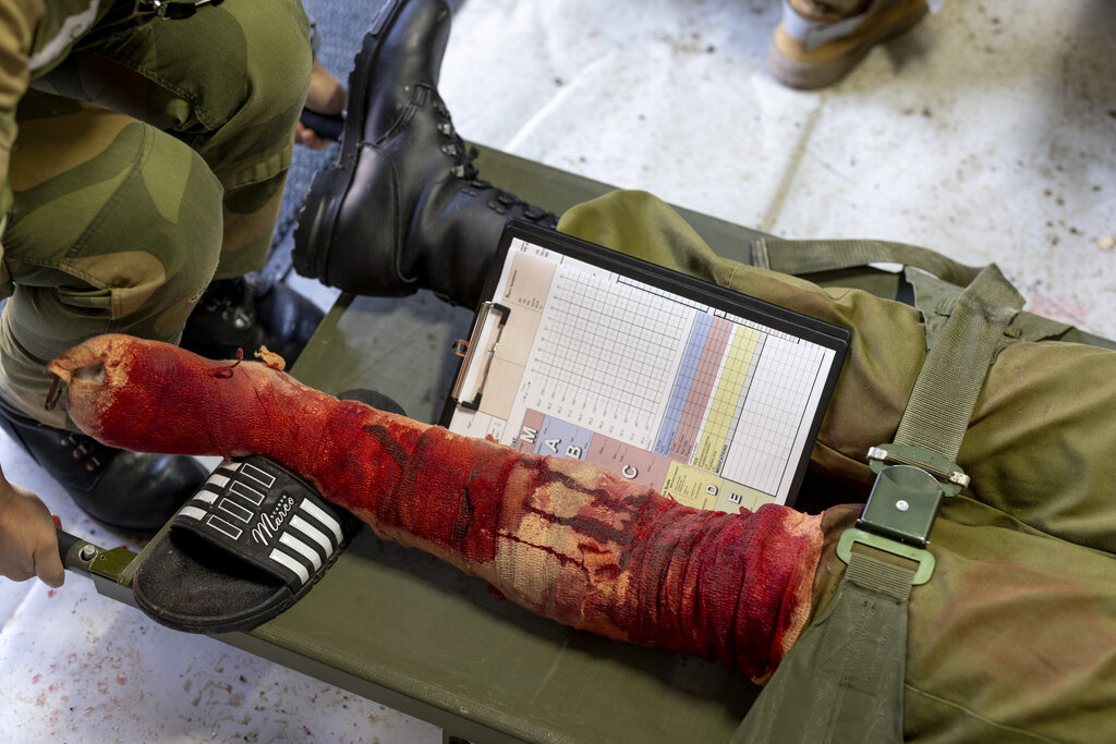 Bildet viser et blodig og bandasjert ben.