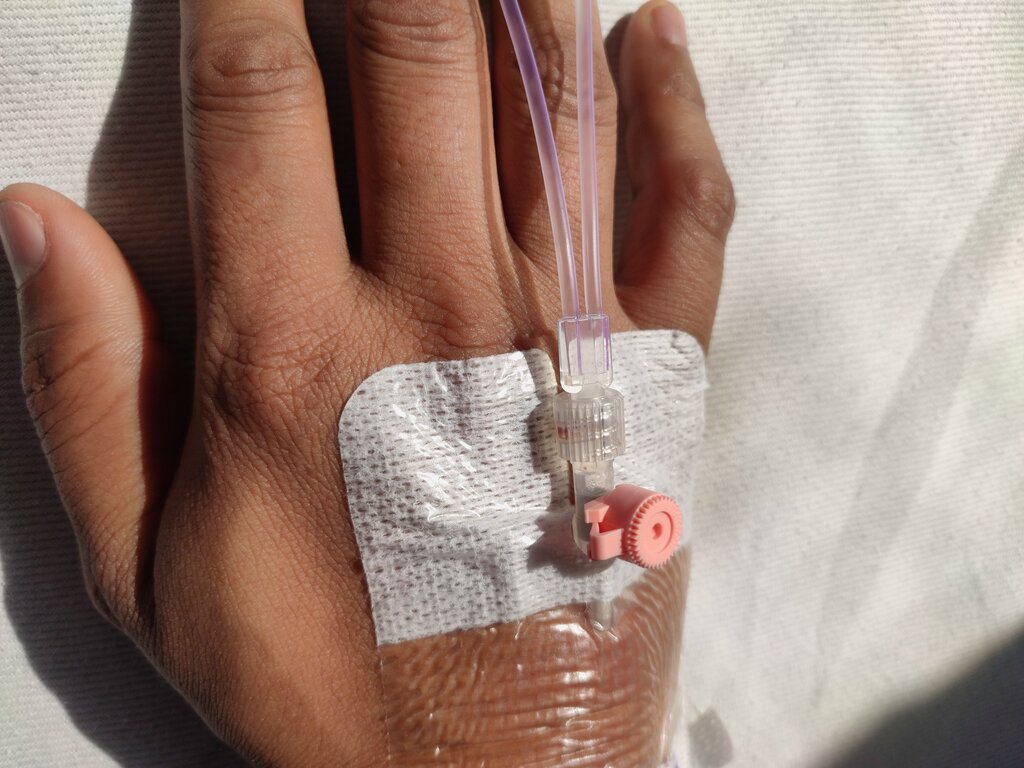 The photo shows a hand with a venous catheter in the vein