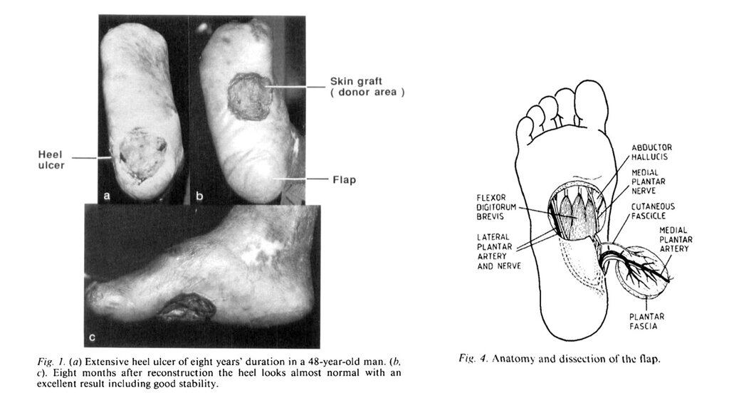 Bildet viser en illustrasjon og et bilde