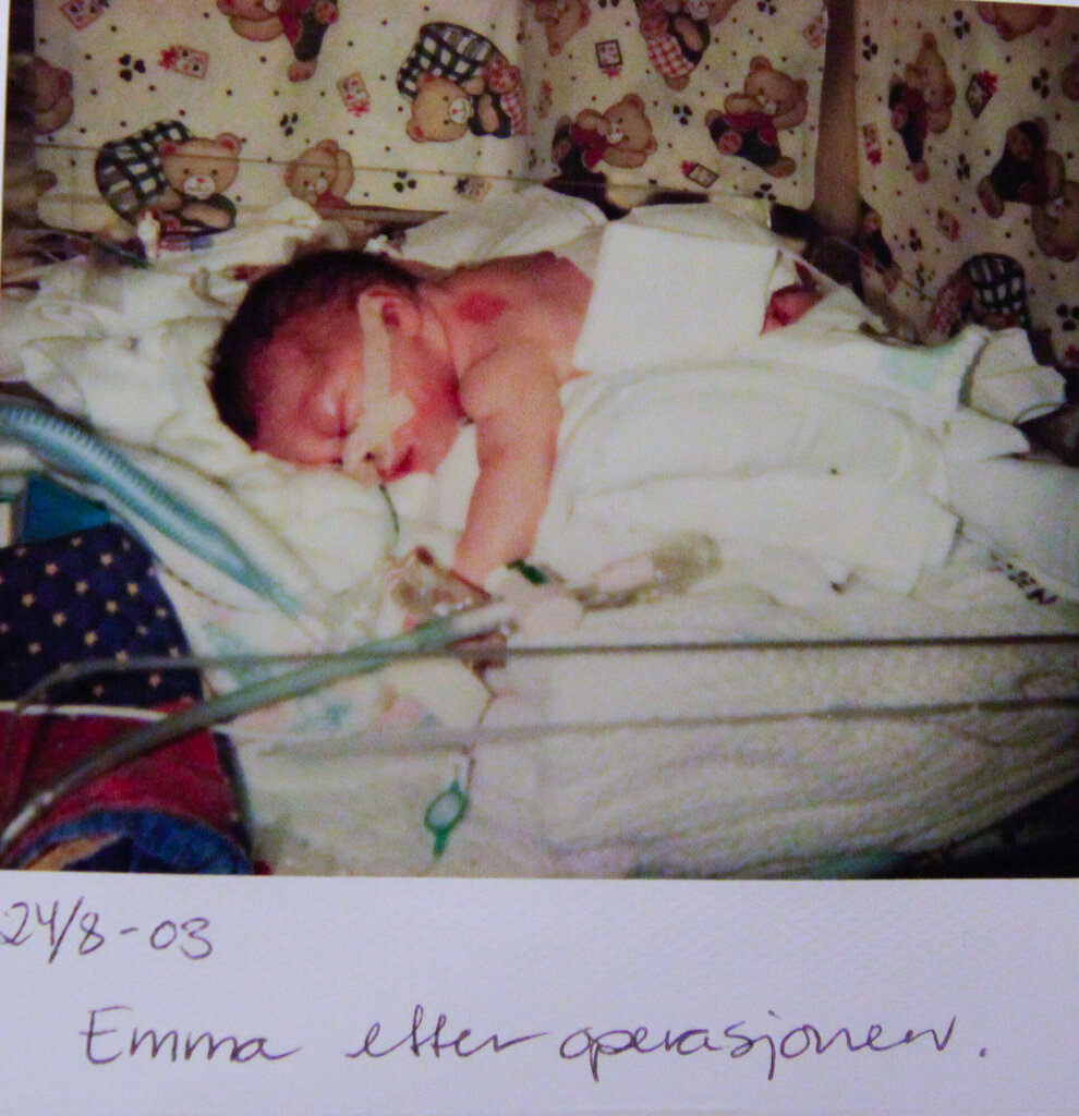 bildet viser Emma som nyfødt og nyoperert