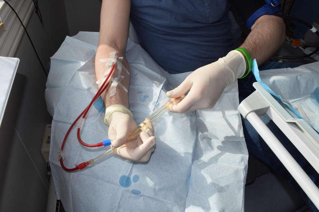 Bildet viser Nikolais hender koplet til diverse dialyseslanger