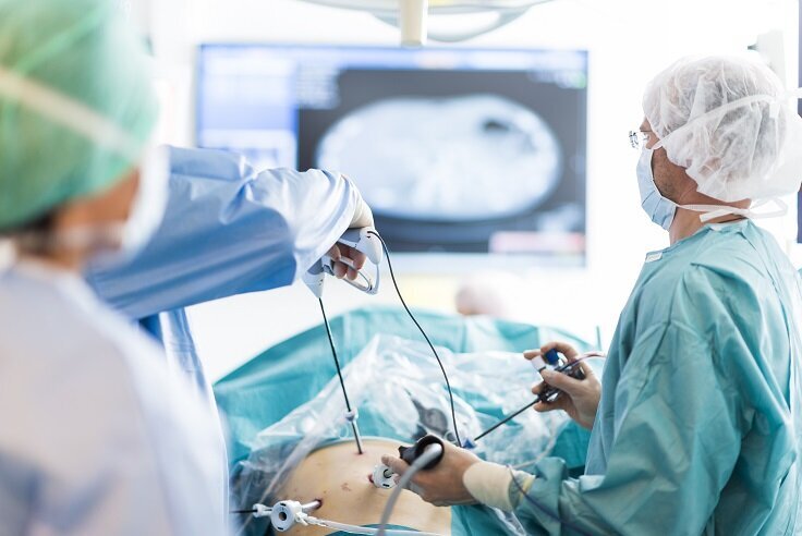Bildet viser en laparoskopisk leverreseksjon ved Intervensjonssenteret på Rikshospitalet.