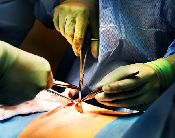 Kirurgi