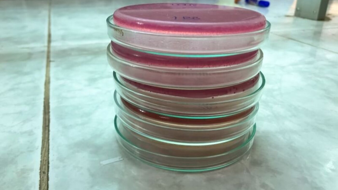 Mikrobiologiske prøver i laboratorium.