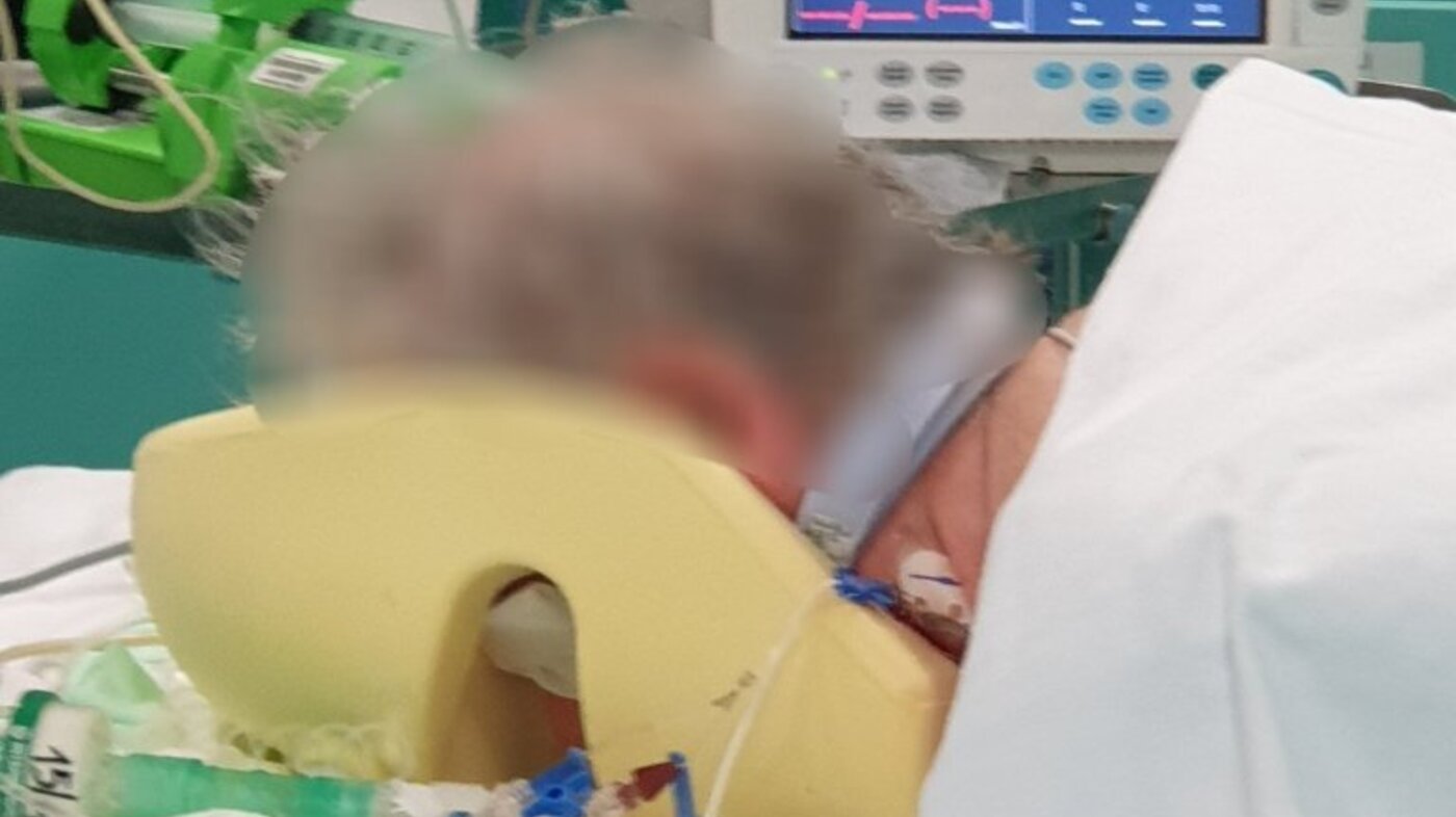 Bildet viser en anonymisert pasient som ligger på magen.