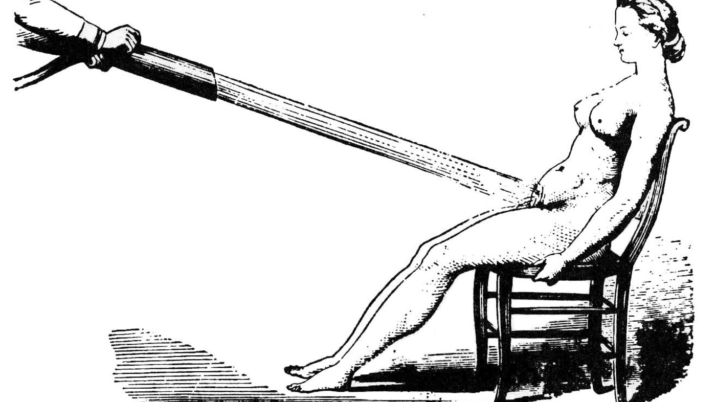Illustrasjonen er en sort-hvitt tegning fra rundt 1860 av en kvinne som blir behandlet for hysteri med en kraftig vannstråle rettet mot underlivet