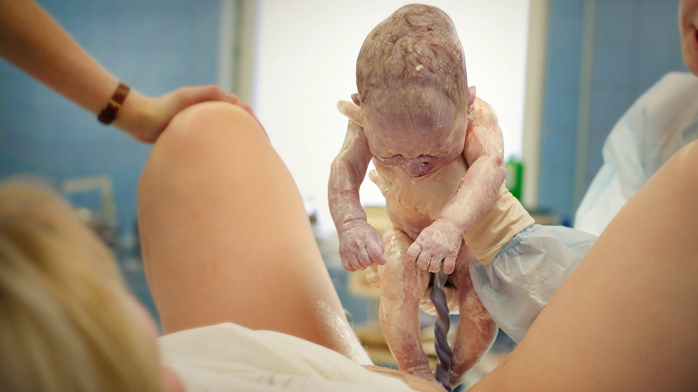 Bildet viser et barn som nettopp er født, og som holdes opp så moren kan få se det.