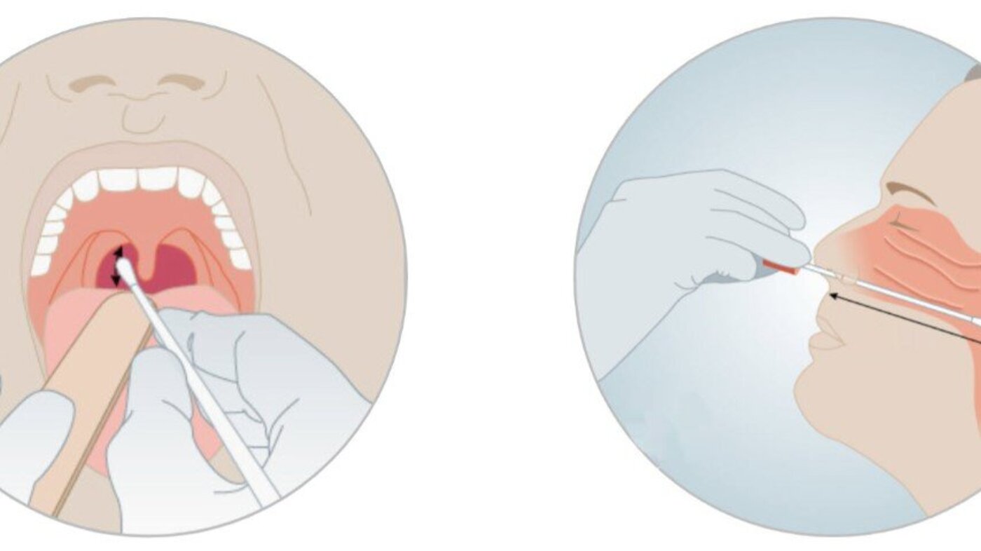 Illustrasjonen viser hvordan koronatest skal tas, i svelg og nese.
