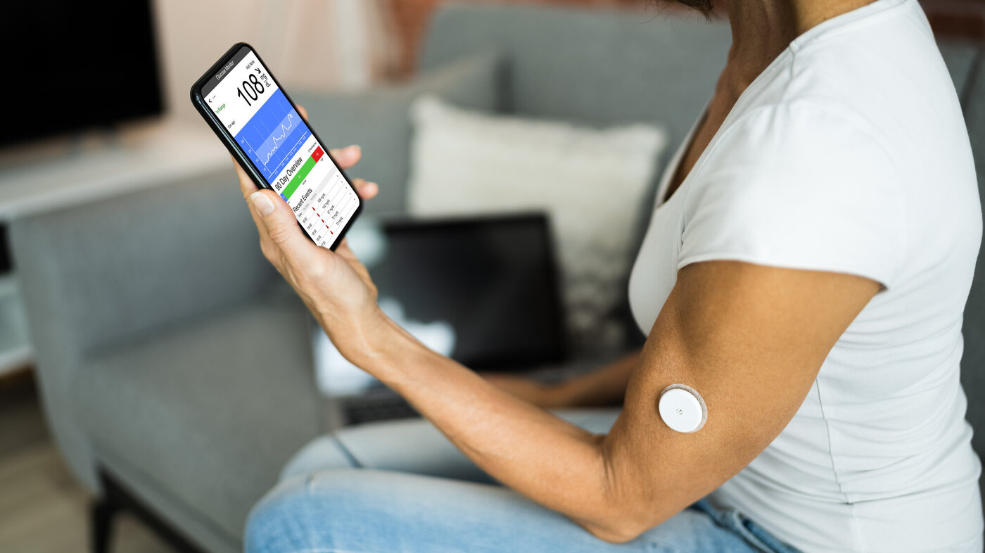 Bildet viser en kvinnelig pasient som bruker CGM (kontinuerlig glukosemåling) for å måle blodsukkeret. Verdiene sendes via bluetooth til mobilen.