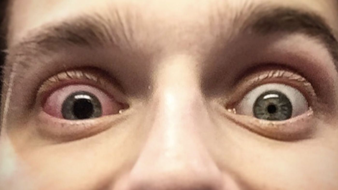 Bildet viser en mann som har to ulike pupiller.