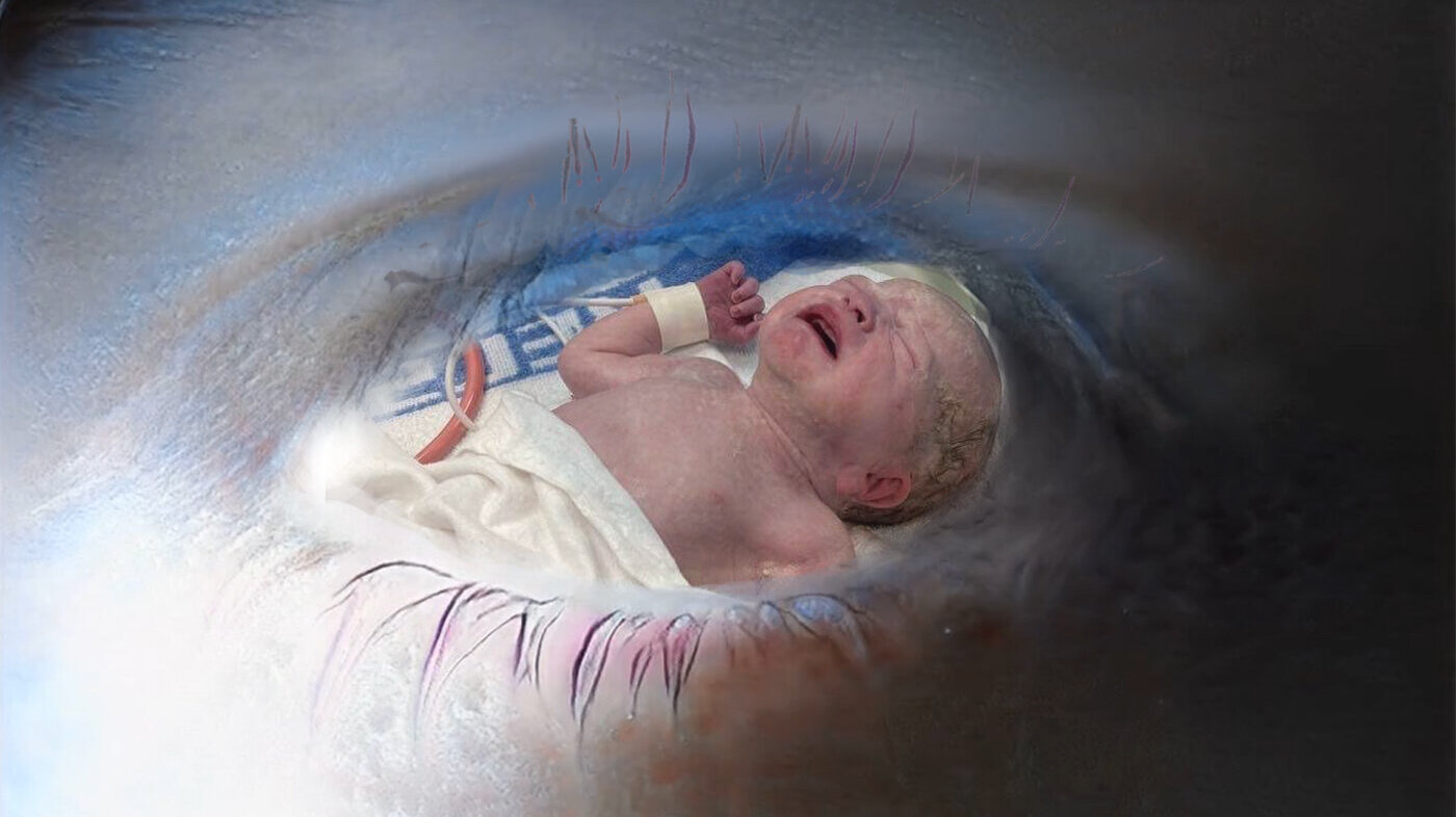Fotomontasjen viser en baby tatt med keisersnitt, som skimtes gjennom et øye.