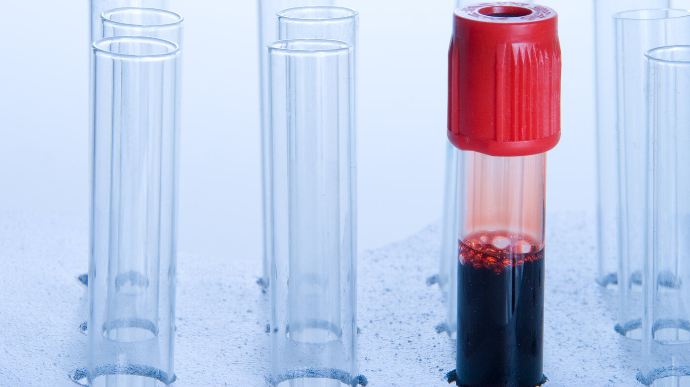 Bildet viser et blodprøveglass fylt med blod.