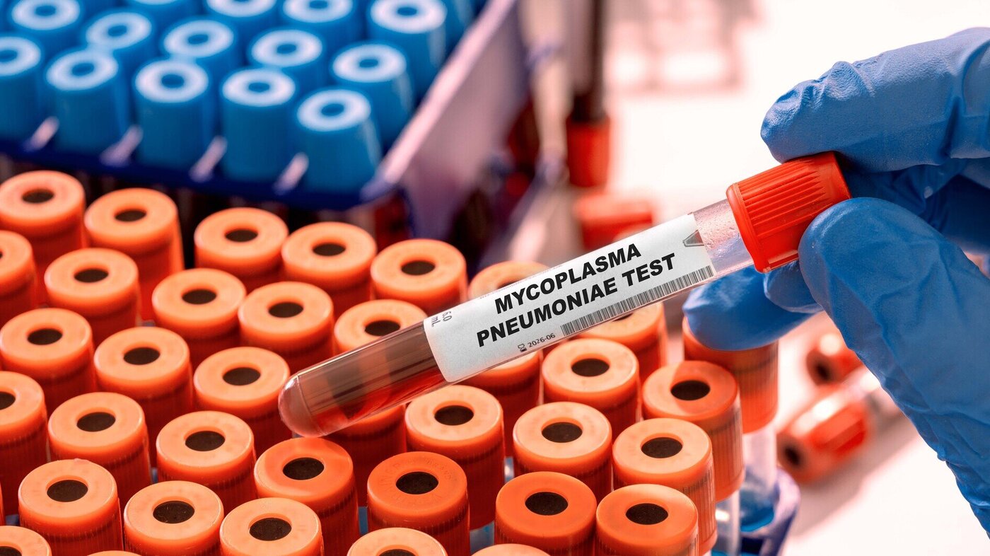 Bilde av mycoplasma pneumoniae-test