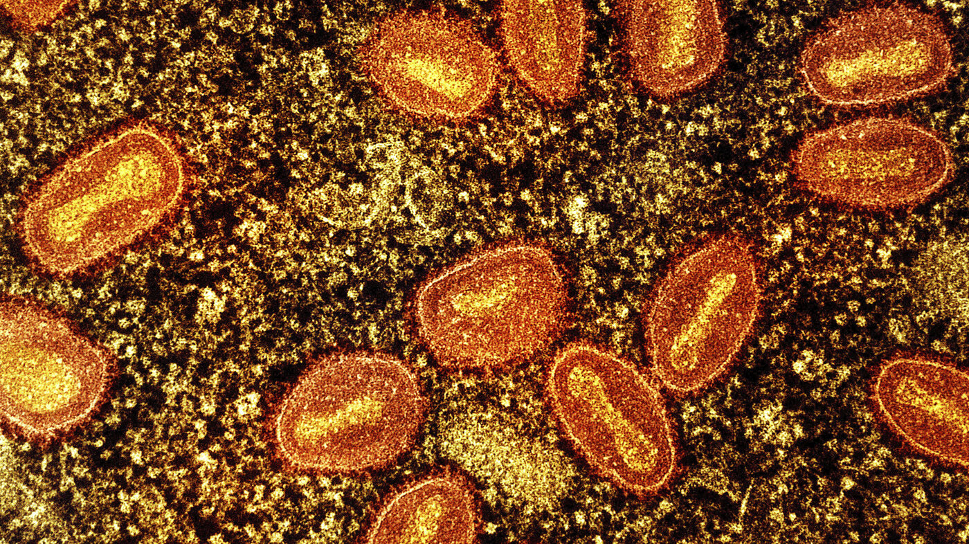Bildet viser mpox-viruspartikler.