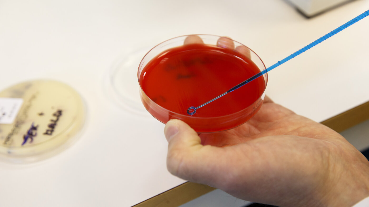 Bilde av en biologisk prøve Bilde av en biologisk prøve