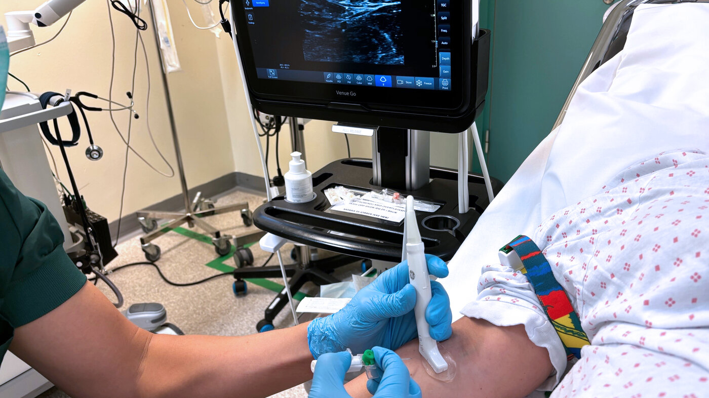 ultrasound-guided PVC The photo shows a nurse using ultrasound to locate a vein before catheterisation
