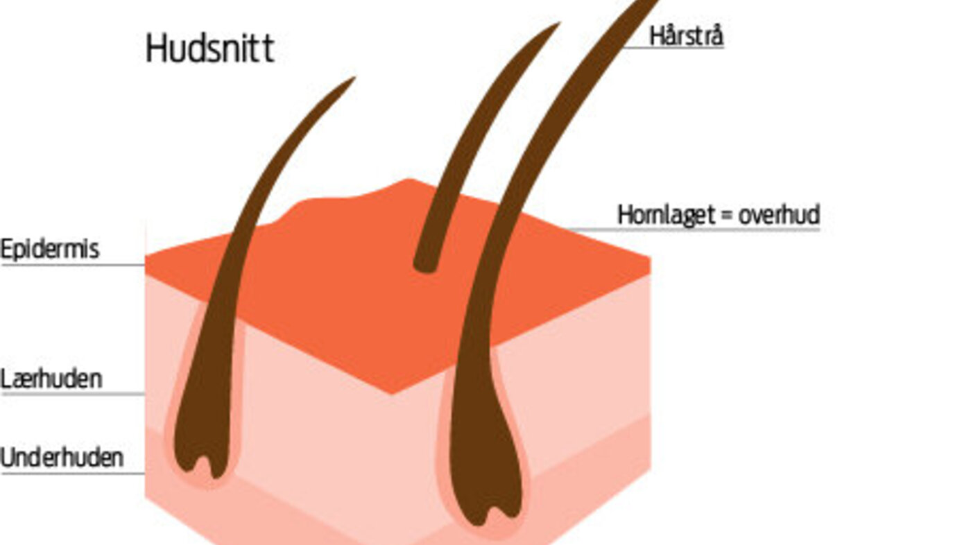 Huden oppbygning 