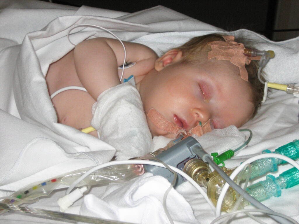Bildet viser Alva på sykehus som baby.
