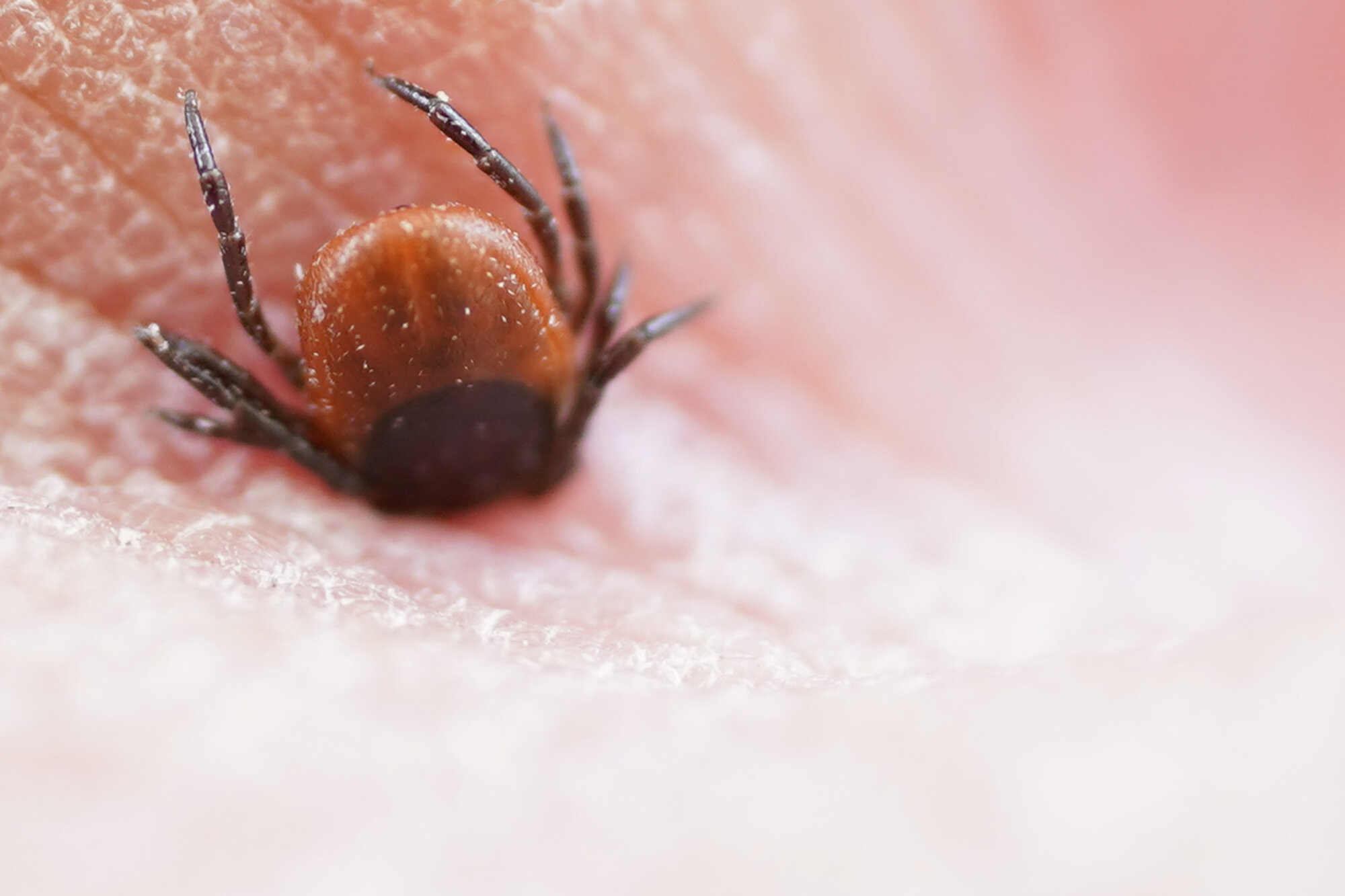 Bilde av flått som har satt seg fast på en hånd