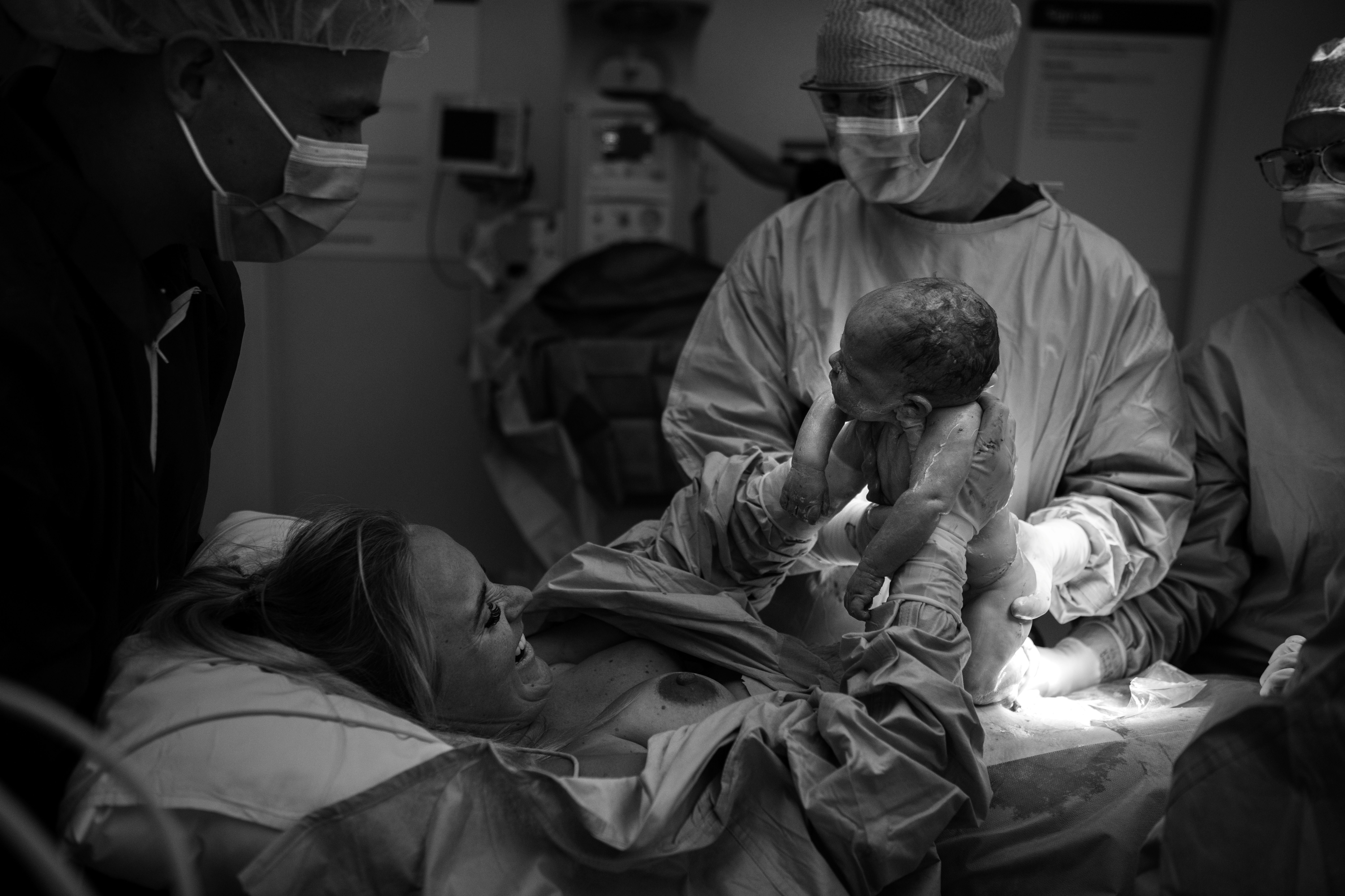 Bildet viser MAC-keisersnitt