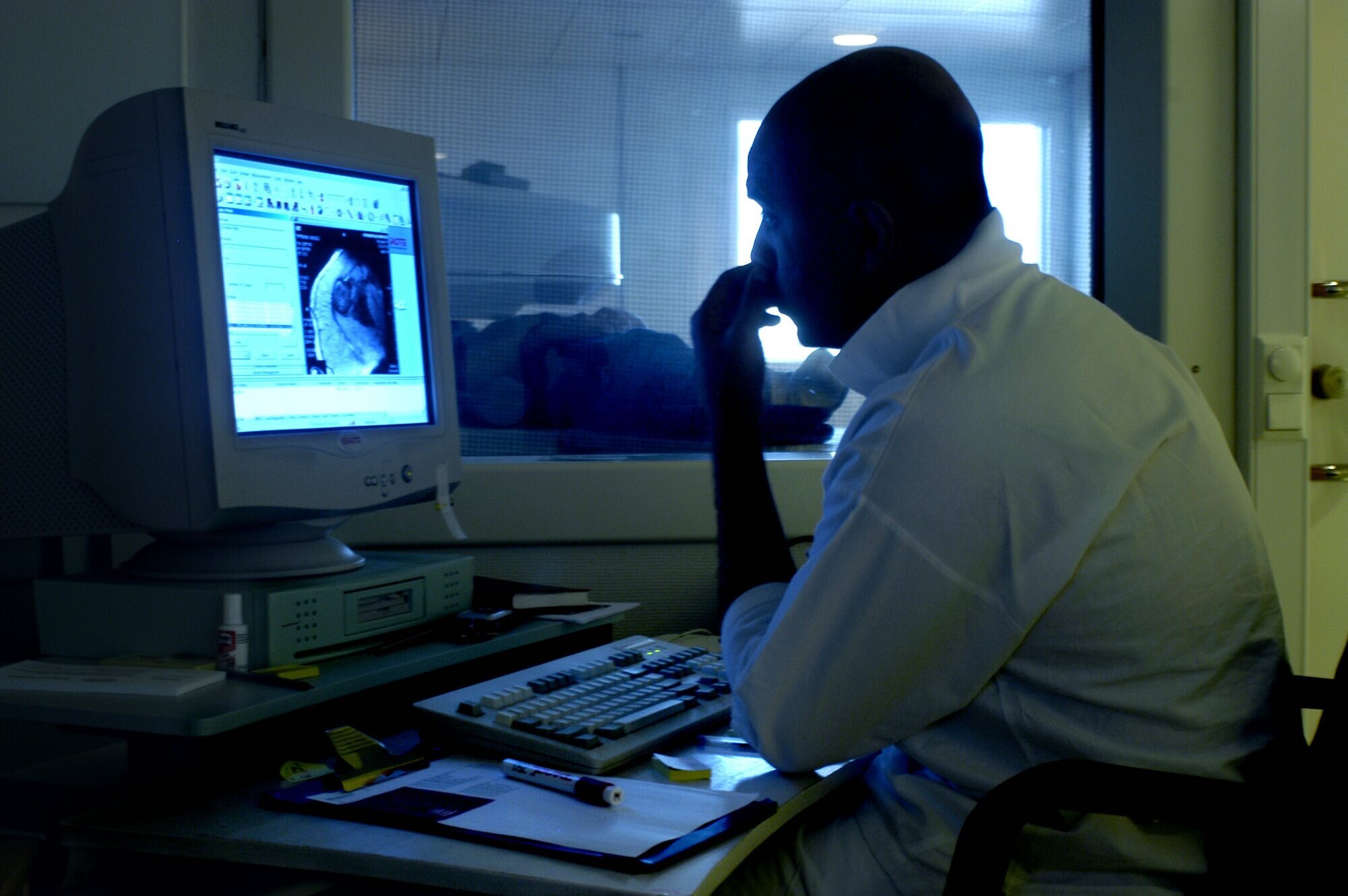 Bildet viser en radiolog som ser på røntgen Bildet viser en radiolog som ser på røntgen