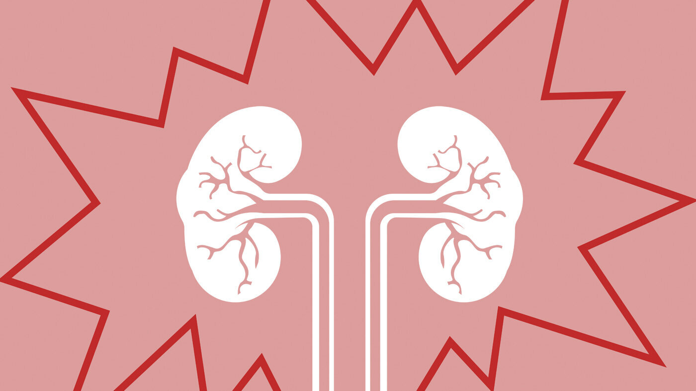 Bildet viser en illustrasjon av to nyrer