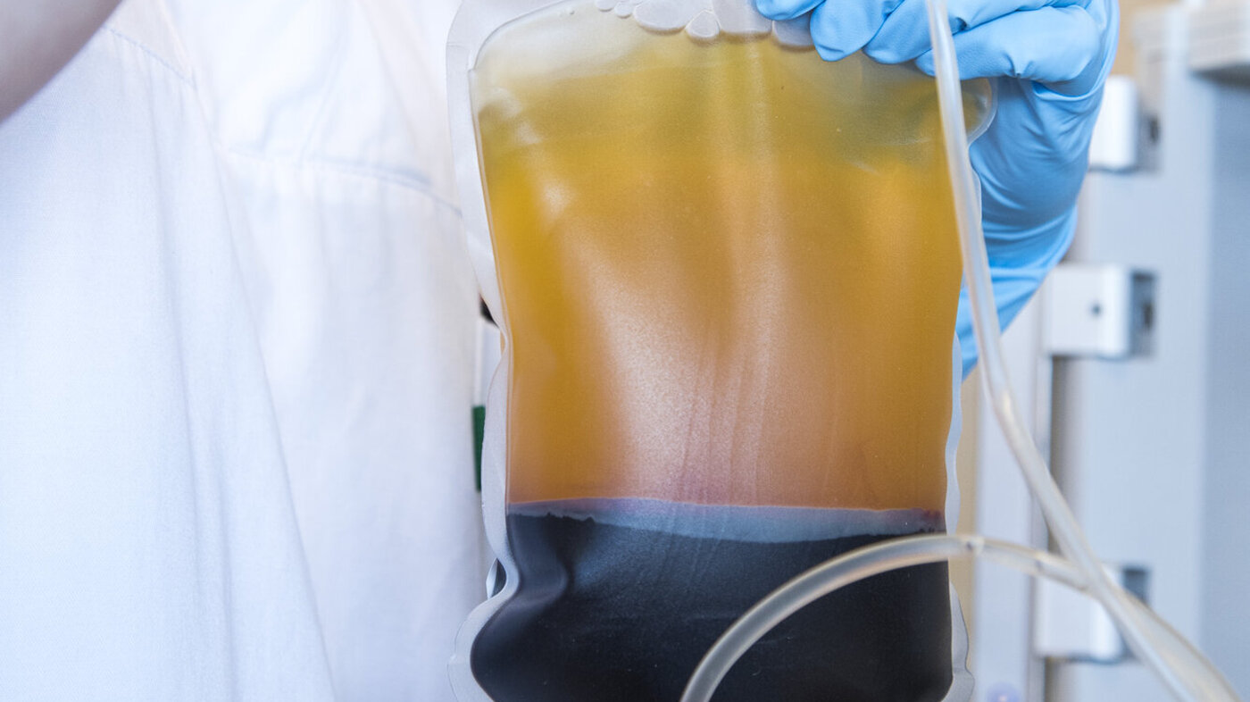 Bildet viser en blodplate med gult plasma på toppen, gulhvit buffy coat i midten og erytrocytter nederst.