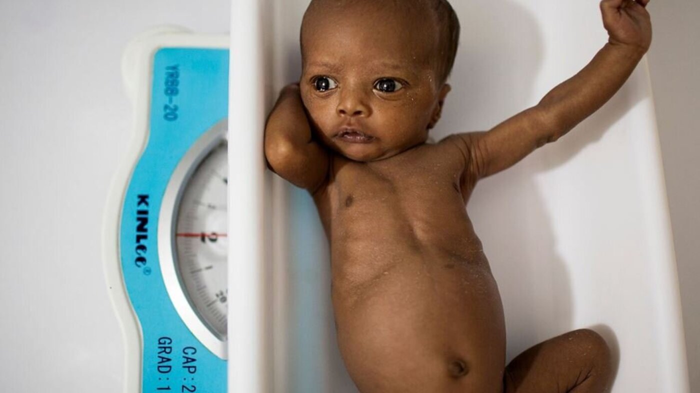 Nyfødt prematur i Somalia på vekt 