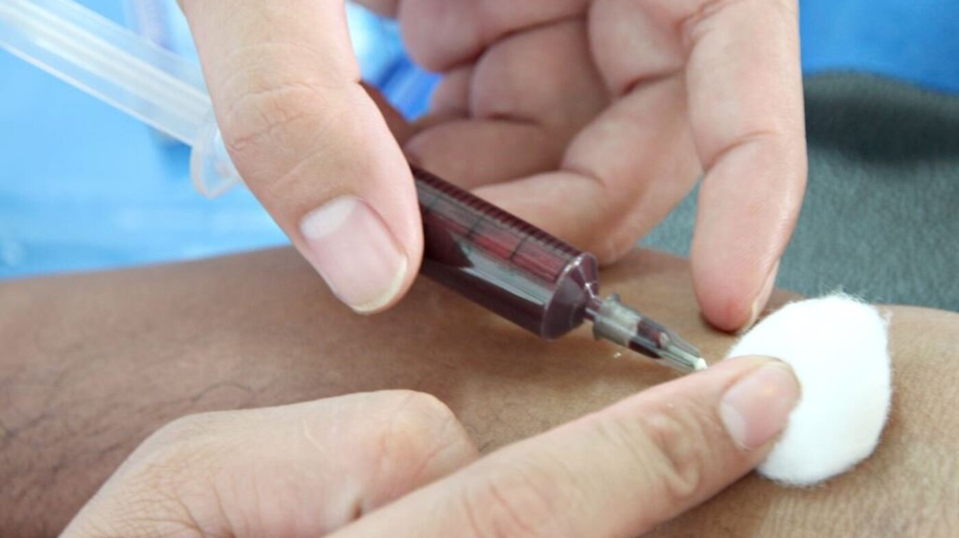 Bildet viser en blodprøvetagning