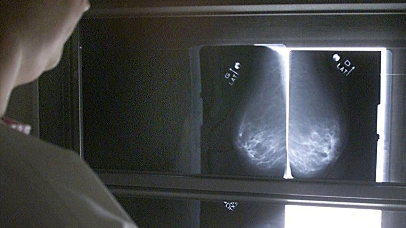 Røntgenbilde