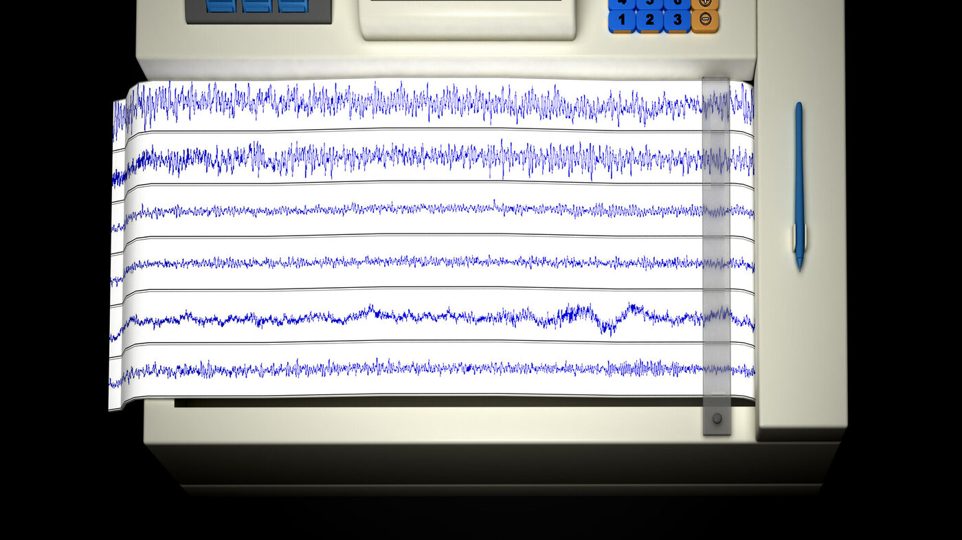 EEG Illustrasjon av en EEG