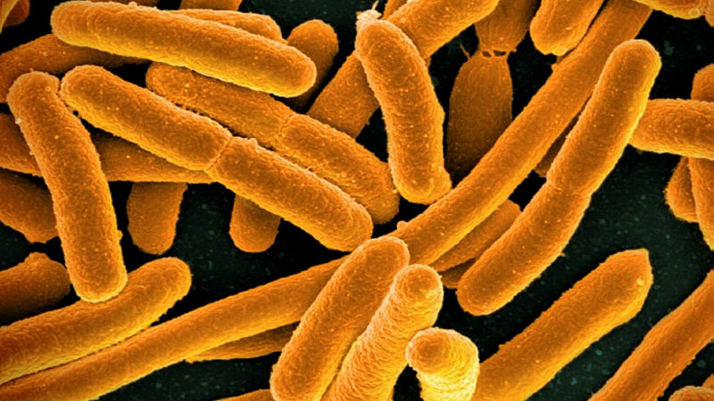 E. coli-bakterier Bildet viser E. coli-bakterier