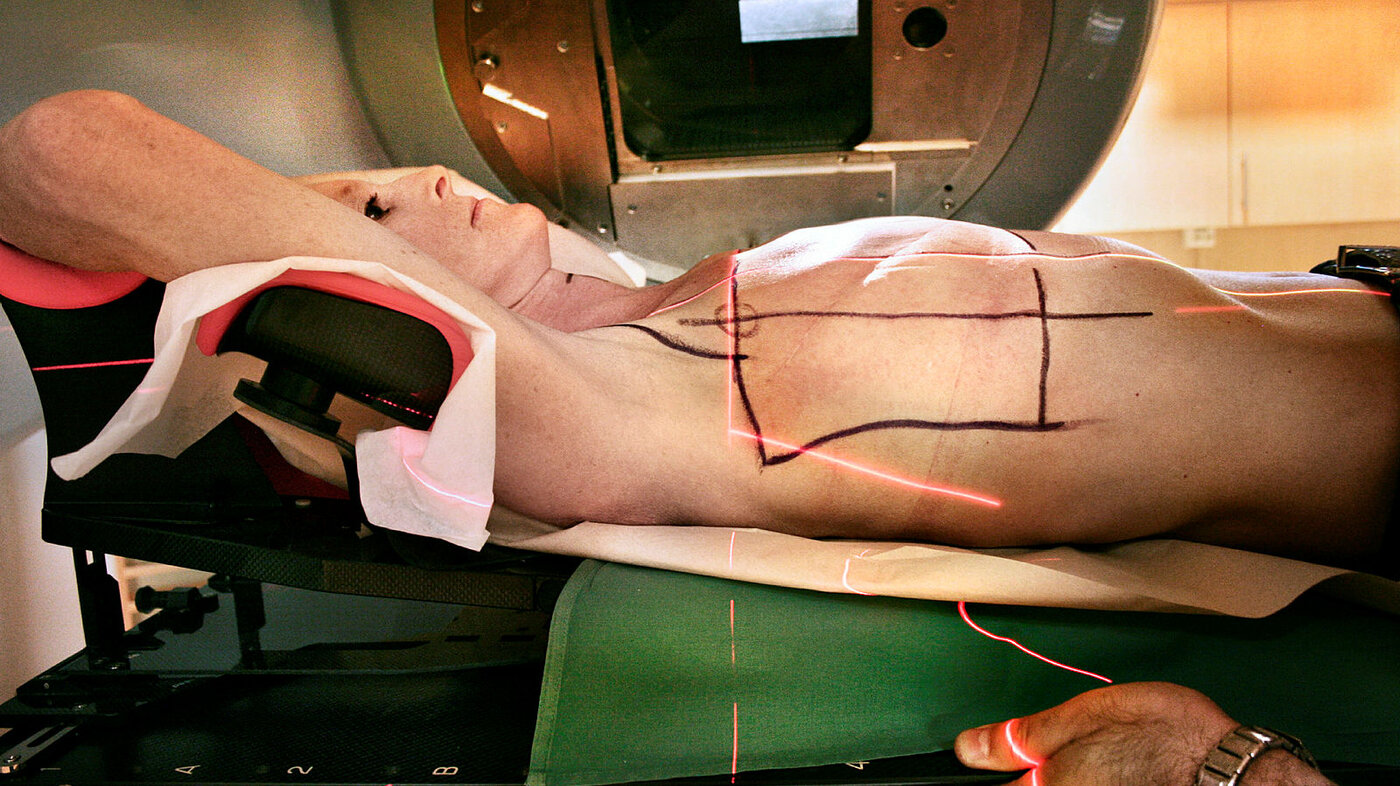 Bildet viser forberedelser før strålebehandling. Vi ser en kvinne som ligger, og som har blitt markert der hvor hun skal bli bestrålt.