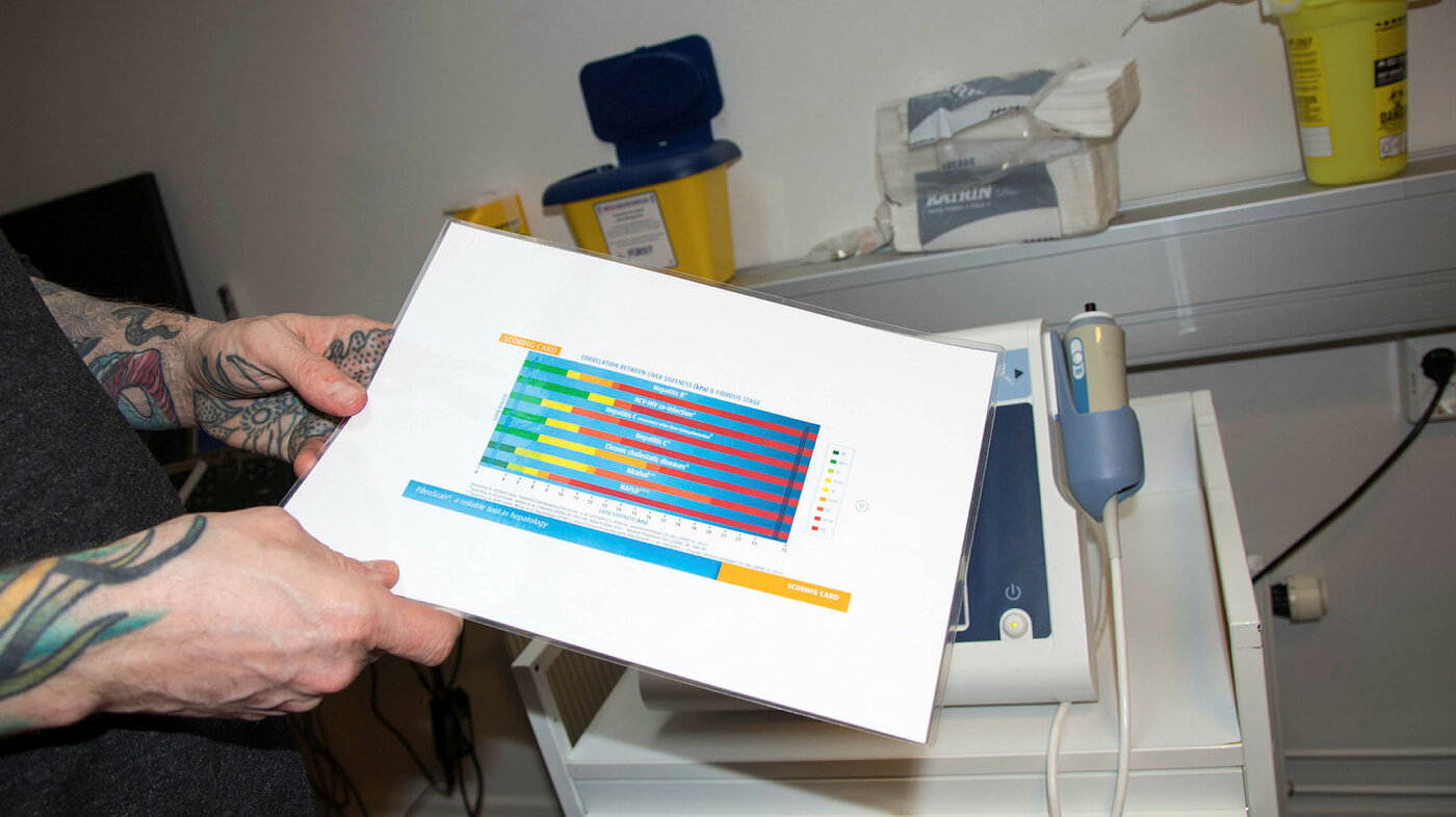 Bildet viser apparatet som brukes til å måle leverens elastisitet. Øystein Sager Backe holder et ark som viser referanseverdier.