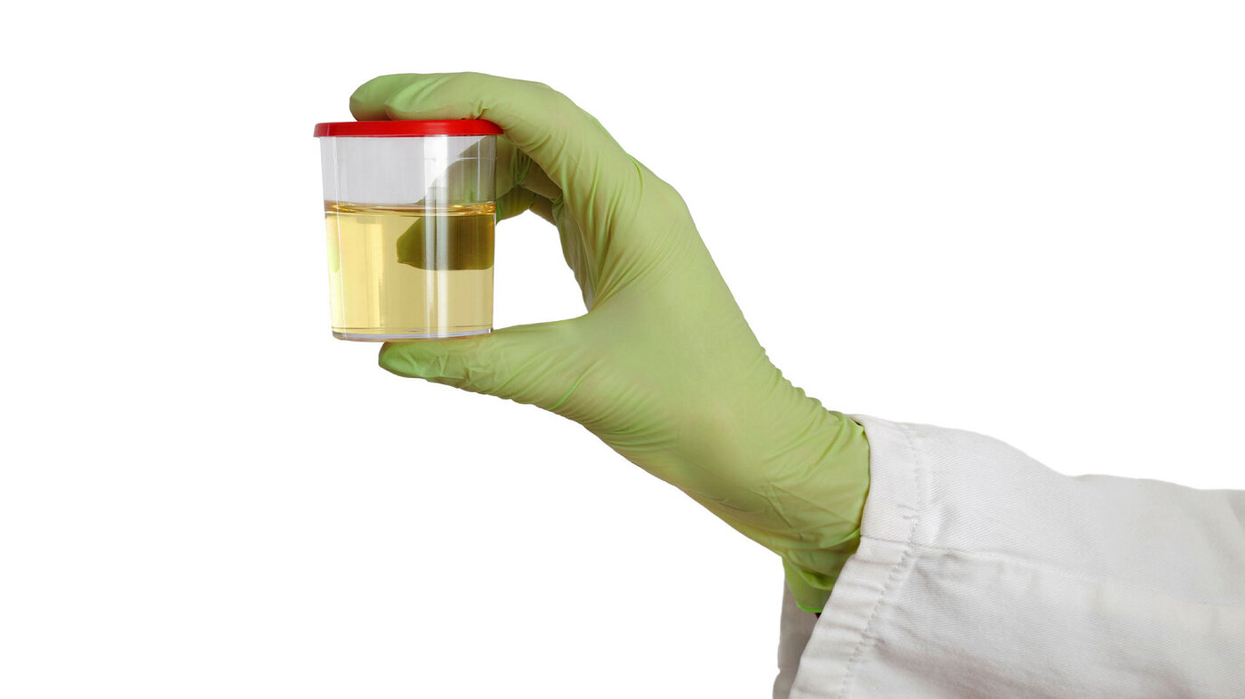 Hånd som holder et urinprøve glass