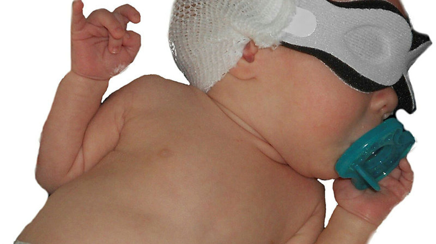 Produktfoto av Bili-Bonnet til bruk på nyfødte med gulsott under lysterapi.
