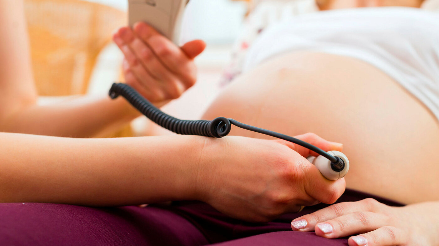 Bildet viser en jordmor som undersøker en gravid kvinne med CTG (kardiotokografi).
