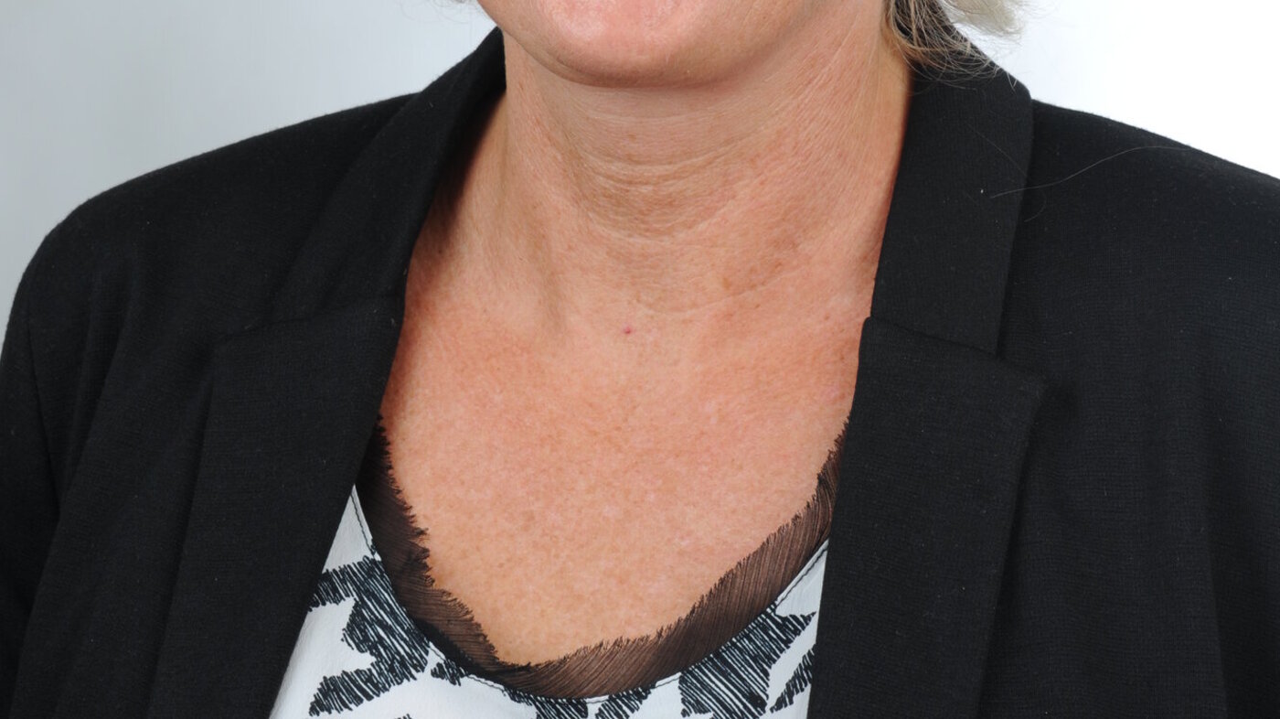 Hilde Skauen Ranum