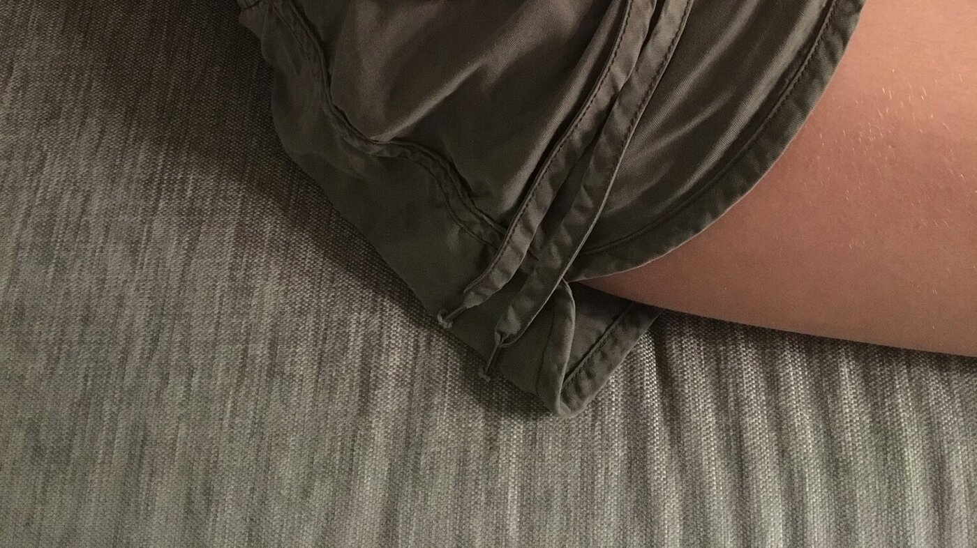 Jente med stomipose. Jente med stomipose på magen.