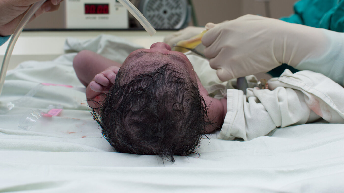 Bilde av en nyfødt prematur baby.