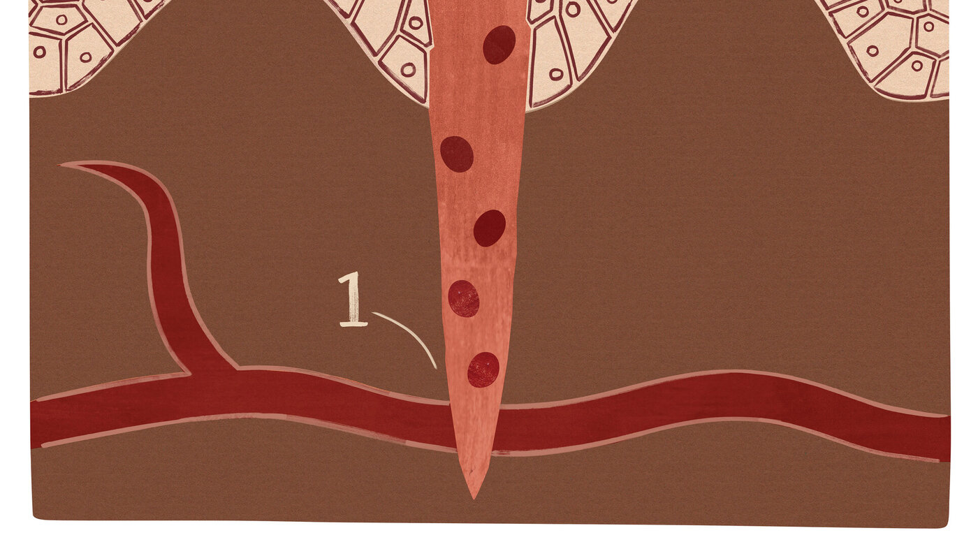 Illustrasjonen viser et sår i koagulasjonsfasen