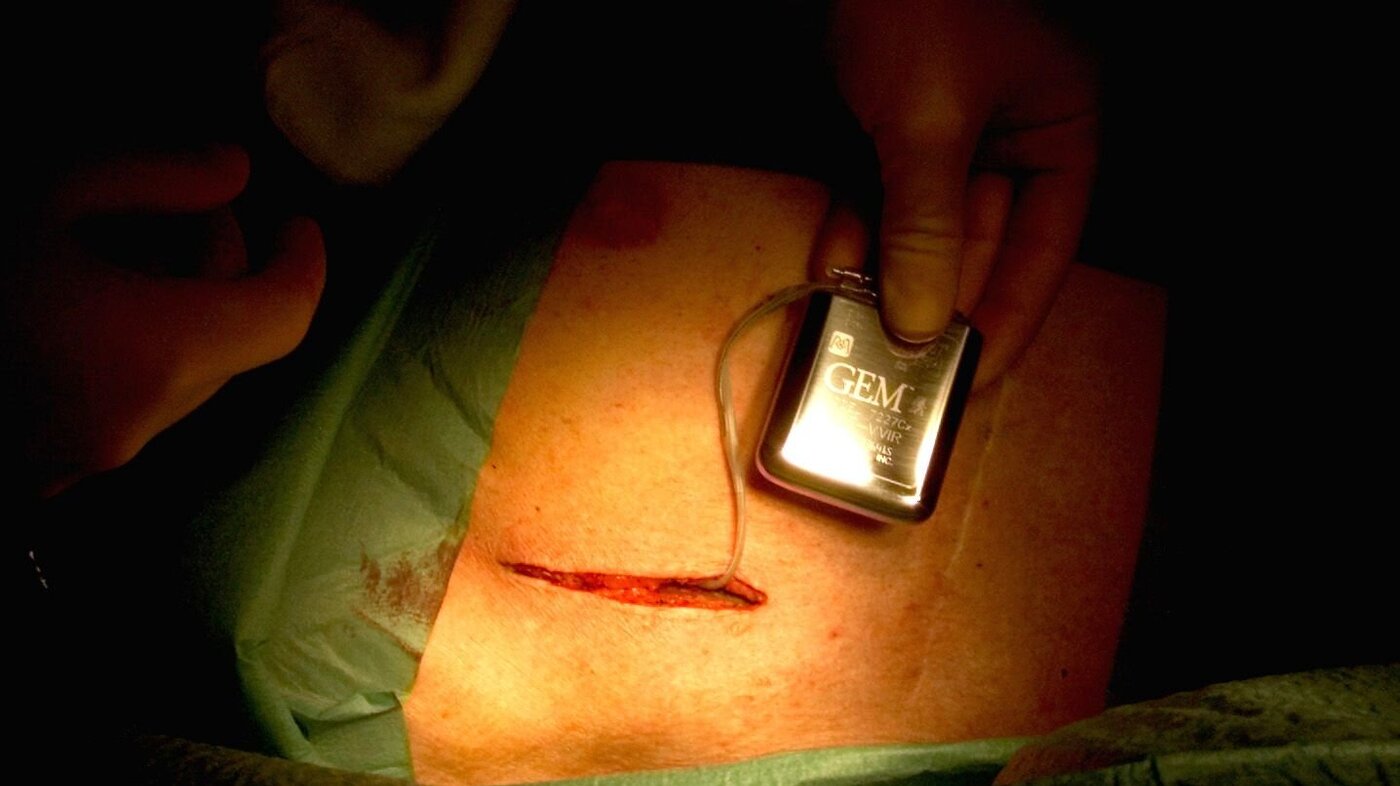Bildet viser en pasient som får operert inn en hjertestarter