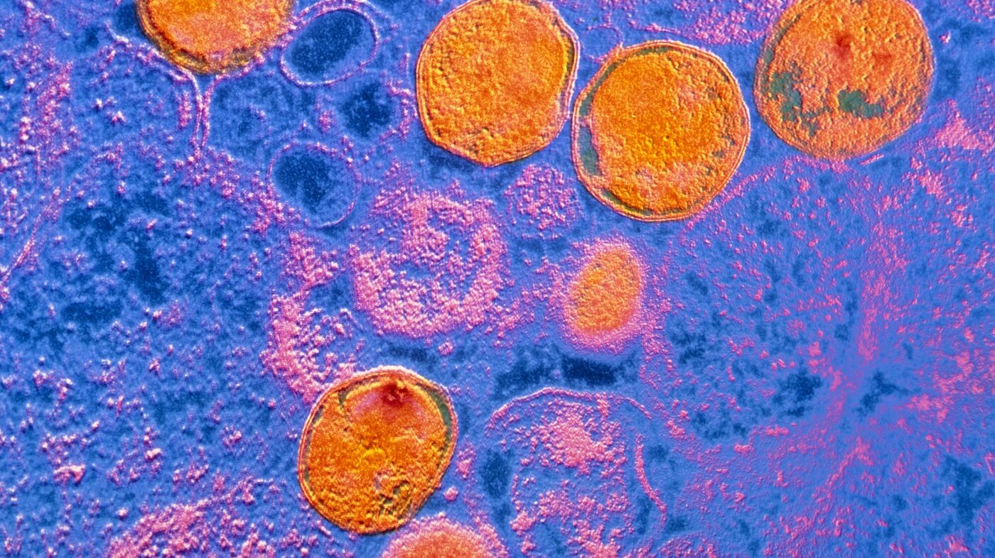 Bildet viser klamydia-bakterier.
