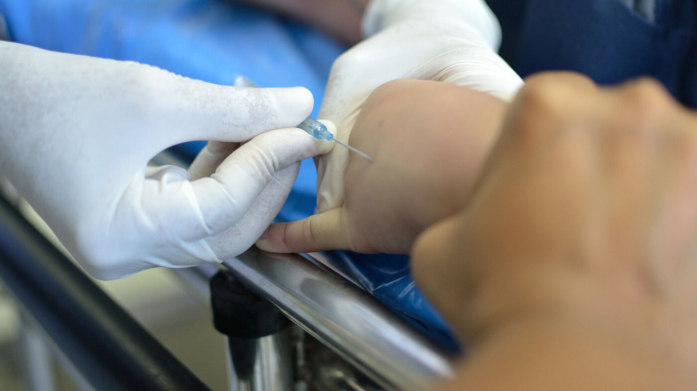 Bilde av en pasient som får lagt inn venekateter i hånden.