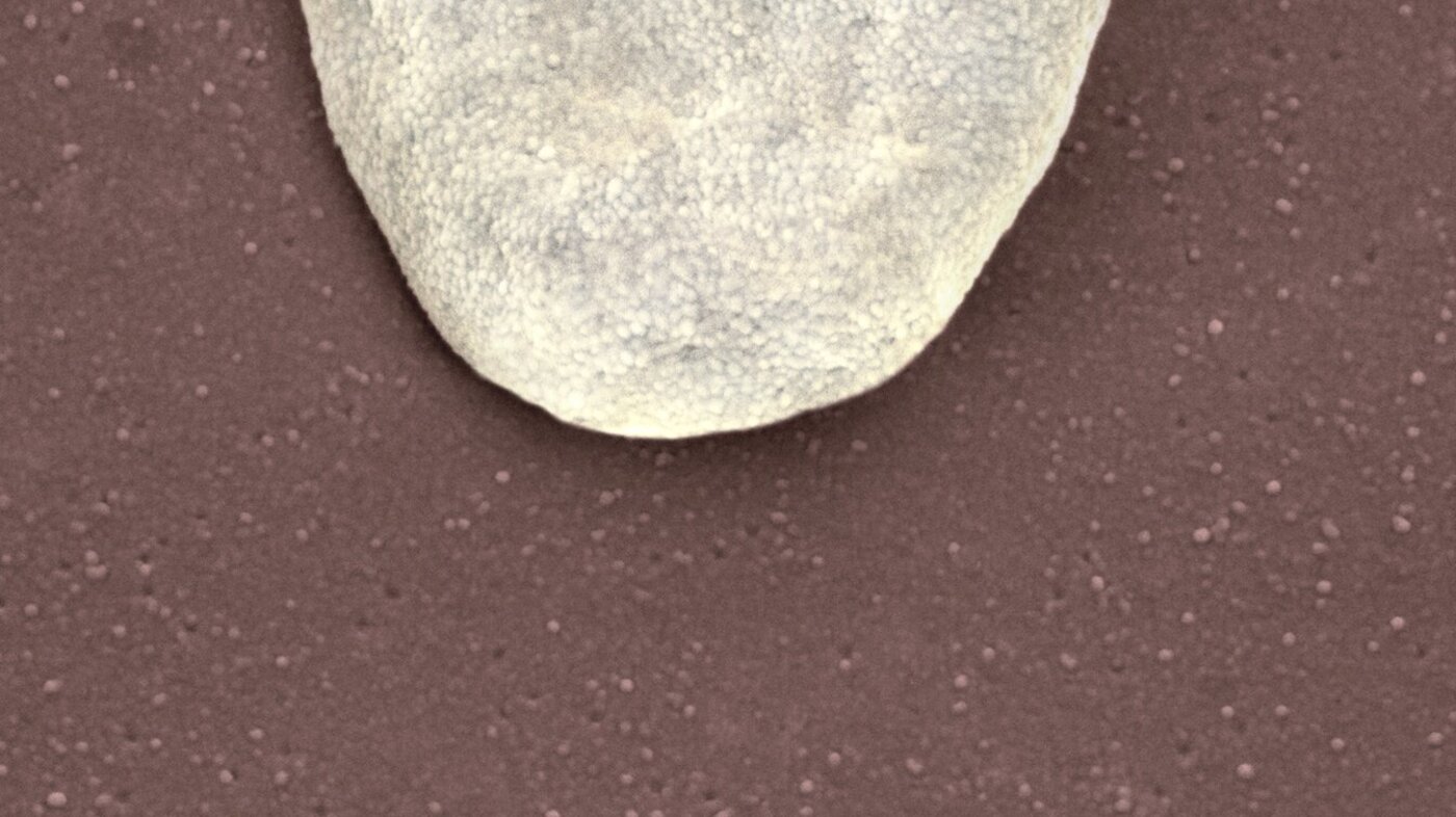 Bildet viser en trombocytt.